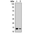 LifeSab™ Leptin Rabbit pAb (50 µl)