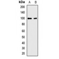 LifeSab™ AIP2 Rabbit pAb (50 µl)