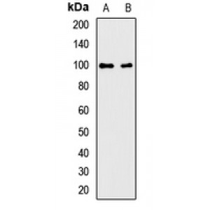 LifeSab™ AIP2 Rabbit pAb (50 µl)