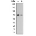 LifeSab™ ACSL4 Rabbit pAb (50 µl)