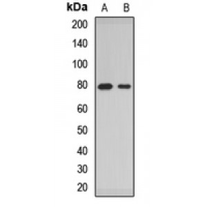 LifeSab™ ACSL4 Rabbit pAb (50 µl)