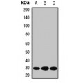 LifeSab™ HPGD Rabbit pAb (50 µl)