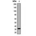 LifeSab™ KCNIP2 Rabbit pAb (50 µl)