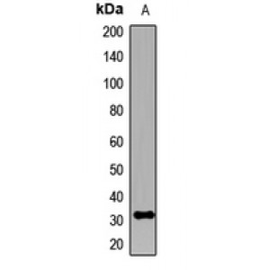 LifeSab™ KCNIP2 Rabbit pAb (50 µl)