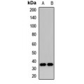 LifeSab™ DIMT1 Rabbit pAb (50 µl)