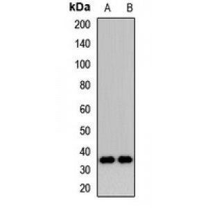 LifeSab™ DIMT1 Rabbit pAb (50 µl)