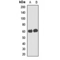 LifeSab™ UGT3A2 Rabbit pAb (50 µl)