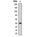 LifeSab™ SHH Rabbit pAb (50 µl)