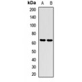 LifeSab™ SETD3 Rabbit pAb (50 µl)