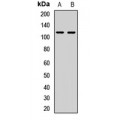 LifeSab™ Semaphorin 4C Rabbit pAb (50 µl)