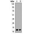 LifeSab™ UBE2NL Rabbit pAb (50 µl)