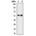 LifeSab™ GTF2H4 Rabbit pAb (50 µl)