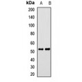 LifeSab™ CALCRL Rabbit pAb (50 µl)