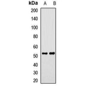 LifeSab™ CALCRL Rabbit pAb (50 µl)