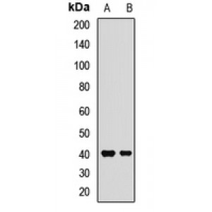 LifeSab™ FcRn Rabbit pAb (50 µl)