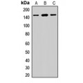 LifeSab™ Desmoglein 2 Rabbit pAb (50 µl)