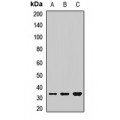 LifeSab™ PHOX2B Rabbit pAb (50 µl)