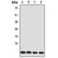 LifeSab™ Tim8A Rabbit pAb (50 µl)