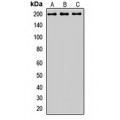 LifeSab™ CD280 Rabbit pAb (50 µl)