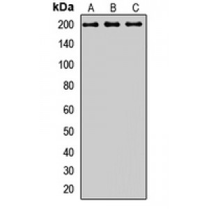 LifeSab™ CD280 Rabbit pAb (50 µl)