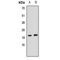 LifeSab™ KCNE2 Rabbit pAb (50 µl)