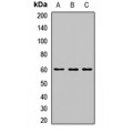 LifeSab™ SOCS6 Rabbit pAb (50 µl)