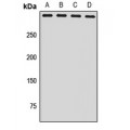 LifeSab™ NSD1 Rabbit pAb (50 µl)