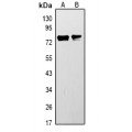 LifeSab™ ACSL3 Rabbit pAb (50 µl)