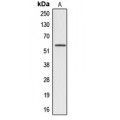 LifeSab™ Alpha 1B glycoprotein Rabbit pAb (50 µl)