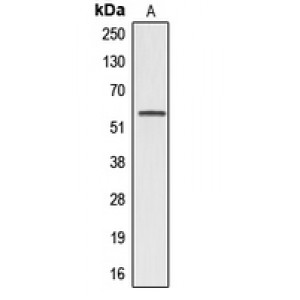 LifeSab™ Alpha 1B glycoprotein Rabbit pAb (50 µl)