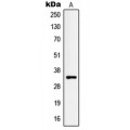 LifeSab™ Kallikrein 3 Rabbit pAb (50 µl)