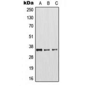 LifeSab™ Arginase 1 Rabbit pAb (50 µl)