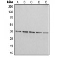 LifeSab™ Arginase 2 Rabbit pAb (50 µl)