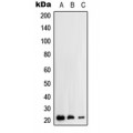 LifeSab™ RhoH Rabbit pAb (50 µl)