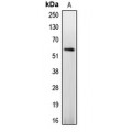 LifeSab™ Caspase 8 (pS347) Rabbit pAb (50 µl)