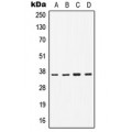 LifeSab™ CD1b Rabbit pAb (50 µl)