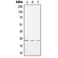 LifeSab™ CD8a Rabbit pAb (50 µl)