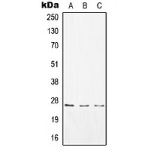 LifeSab™ CD8a Rabbit pAb (50 µl)