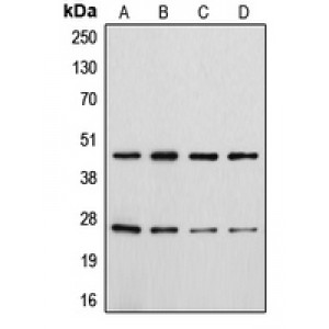 LifeSab™ CD28 (pY218) Rabbit pAb (50 µl)