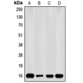 LifeSab™ p16 INK4a Rabbit pAb (50 µl)