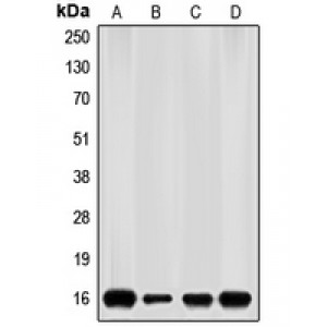 LifeSab™ p16 INK4a Rabbit pAb (50 µl)