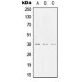 LifeSab™ CD66b Rabbit pAb (50 µl)