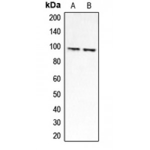 LifeSab™ CLCN6 Rabbit pAb (50 µl)