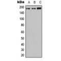 LifeSab™ MRP2 Rabbit pAb (50 µl)