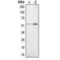 LifeSab™ Carboxypeptidase E Rabbit pAb (50 µl)