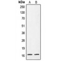 LifeSab™ CRABP2 Rabbit pAb (50 µl)