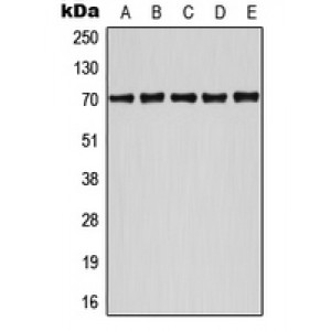 LifeSab™ ATF2 (pS498) Rabbit pAb (50 µl)