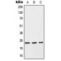 LifeSab™ C-Reactive Protein Rabbit pAb (50 µl)