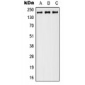 LifeSab™ Neurocan Rabbit pAb (50 µl)