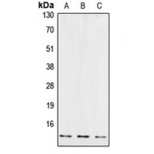 LifeSab™ Cystatin B Rabbit pAb (50 µl)